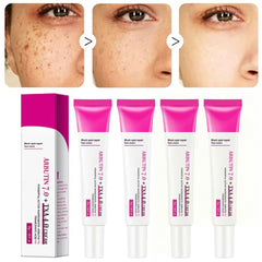 Arbutin 7.0+TXA 4.0 Cream Black Spot Repair Face Cream Fade Dark Spot Niacinamide Freckle Blemishes Brightening Korean Skin Care