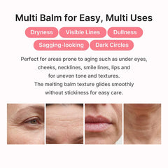 Medicube PDRN Pink Collagen Volume Multi Balm — 5% Volufiline Anti-Aging Stick